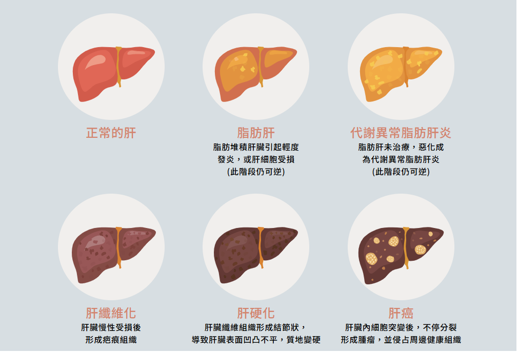 脂肪肝 就是有病 !